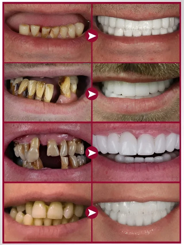 Oralhoe denture adhesive