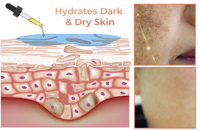 ✨Fast Dark Spot Remover-YIRANTIAN Melanin Correcting Facial Serum