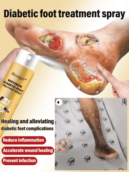 Diabetic foot treatment spray
