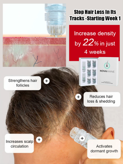 Reverse Hair Loss Roller Essence Set