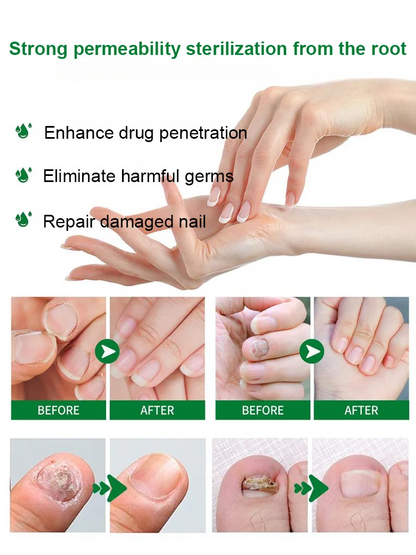 [Nail Care Solution]Professional Nail Repair Solution – Strengthen & Restore Nails
