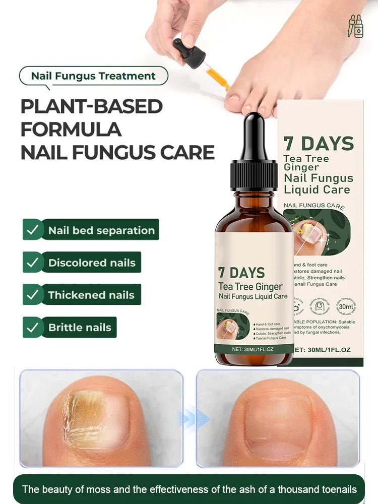 [Nail Care Solution]Professional Nail Repair Solution – Strengthen & Restore Nails
