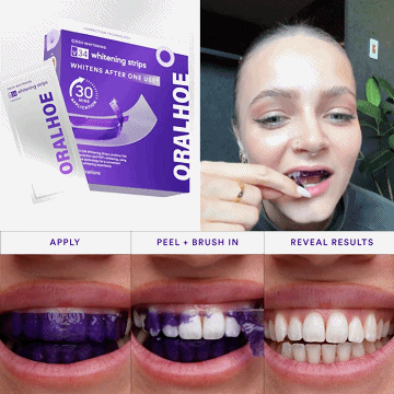 【Latest research and development】Purple instant whitening teeth stickers