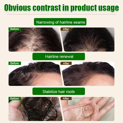 [Hair volume increases rapidly] Promote hair growth and strengthen hair care essential oil