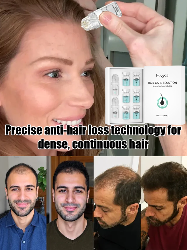 Reverse Hair Loss Roller Essence Set