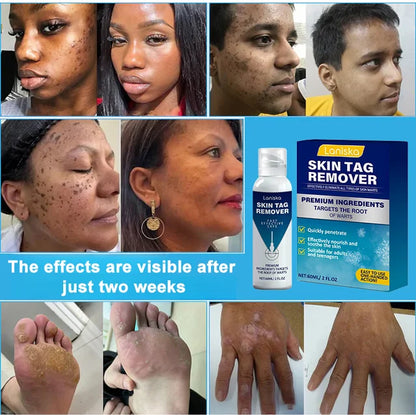 Cryotherapy Spray🌬️Instant cooling relief—say goodbye to discomfort, hello to comfort!