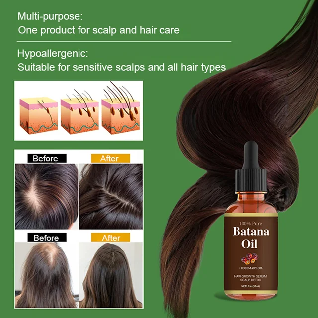 [Hair volume increases rapidly] Promote hair growth and strengthen hair care essential oil