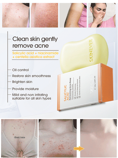 [Washes away 99.9% of dust mites] Salicylic acid soap