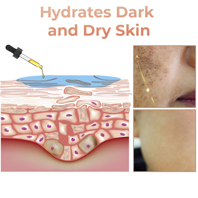 ✨Fast Dark Spot Remover-YIRANTIAN Melanin Correcting Facial Serum