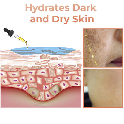 ✨Fast Dark Spot Remover-YIRANTIAN Melanin Correcting Facial Serum