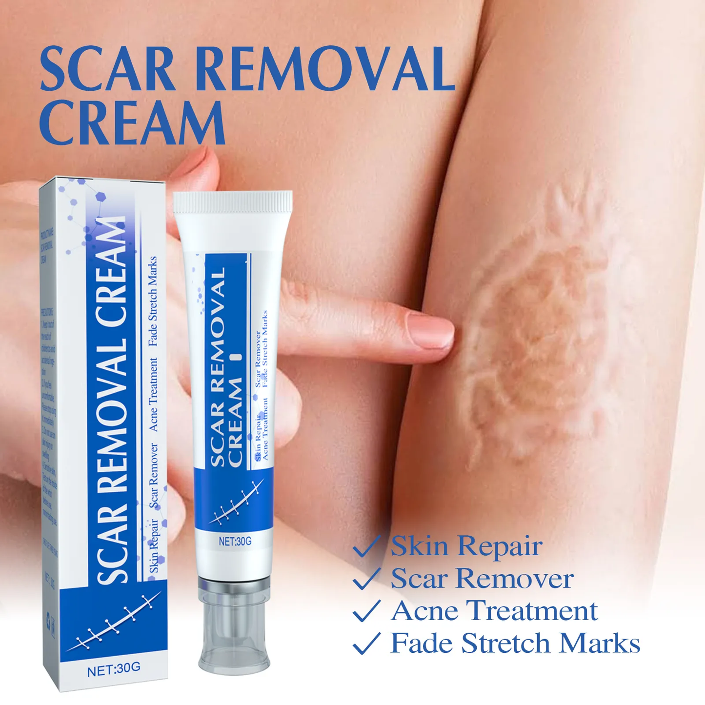 Scar Repair Cream for Men and Women, fade scars and tighten skin in one step