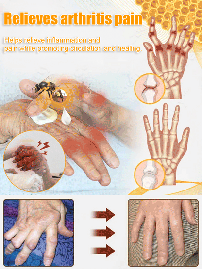 Bee Venom Joint Repair Cream