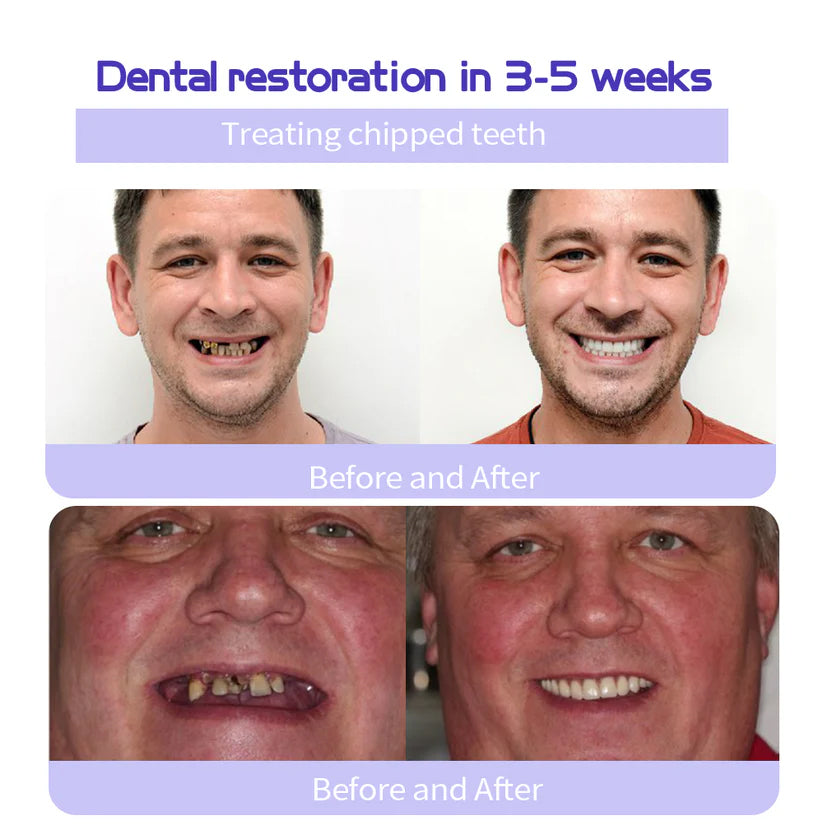 GarageLine® Teeth Restoration Mineral Powder