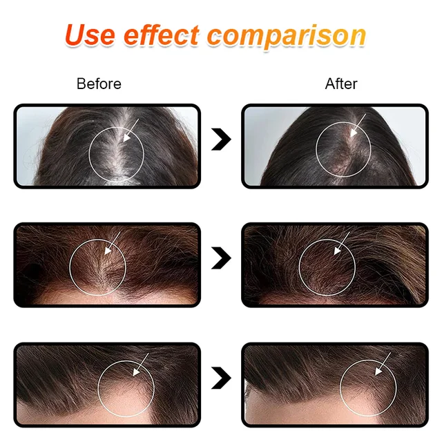 Batana Oil for Strengthening Hair and Preventing Hair Loss