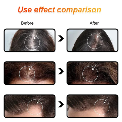 Batana Oil for Strengthening Hair and Preventing Hair Loss