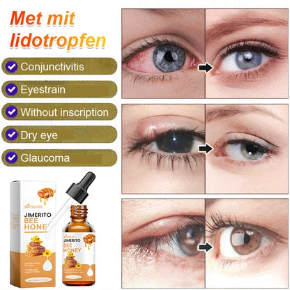 Honey Eye Care Solution
