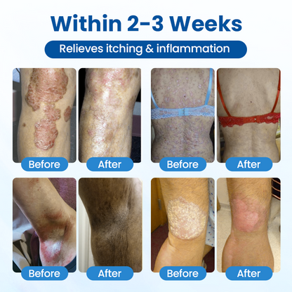 Zvoevo® PCA Magnesium Deep Repair Spray