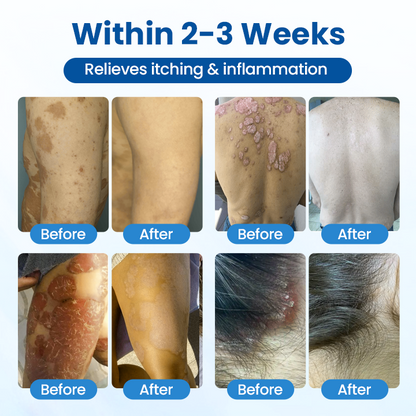 Zvoevo® PCA Magnesium Deep Repair Spray