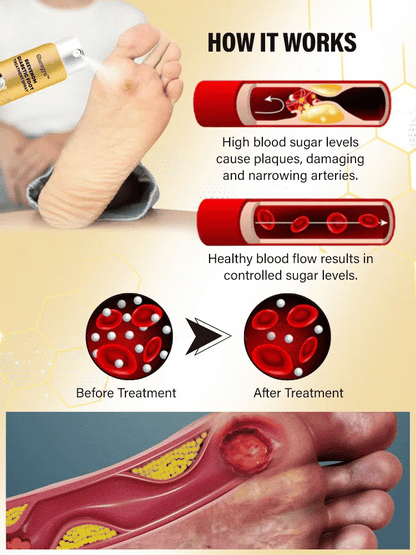 Diabetic foot treatment spray