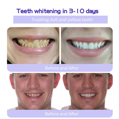 GarageLine® Teeth Restoration Mineral Powder