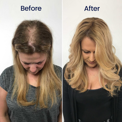 Maximum Strength 5% Minoxidil Fast-Action Hair Growth Serum