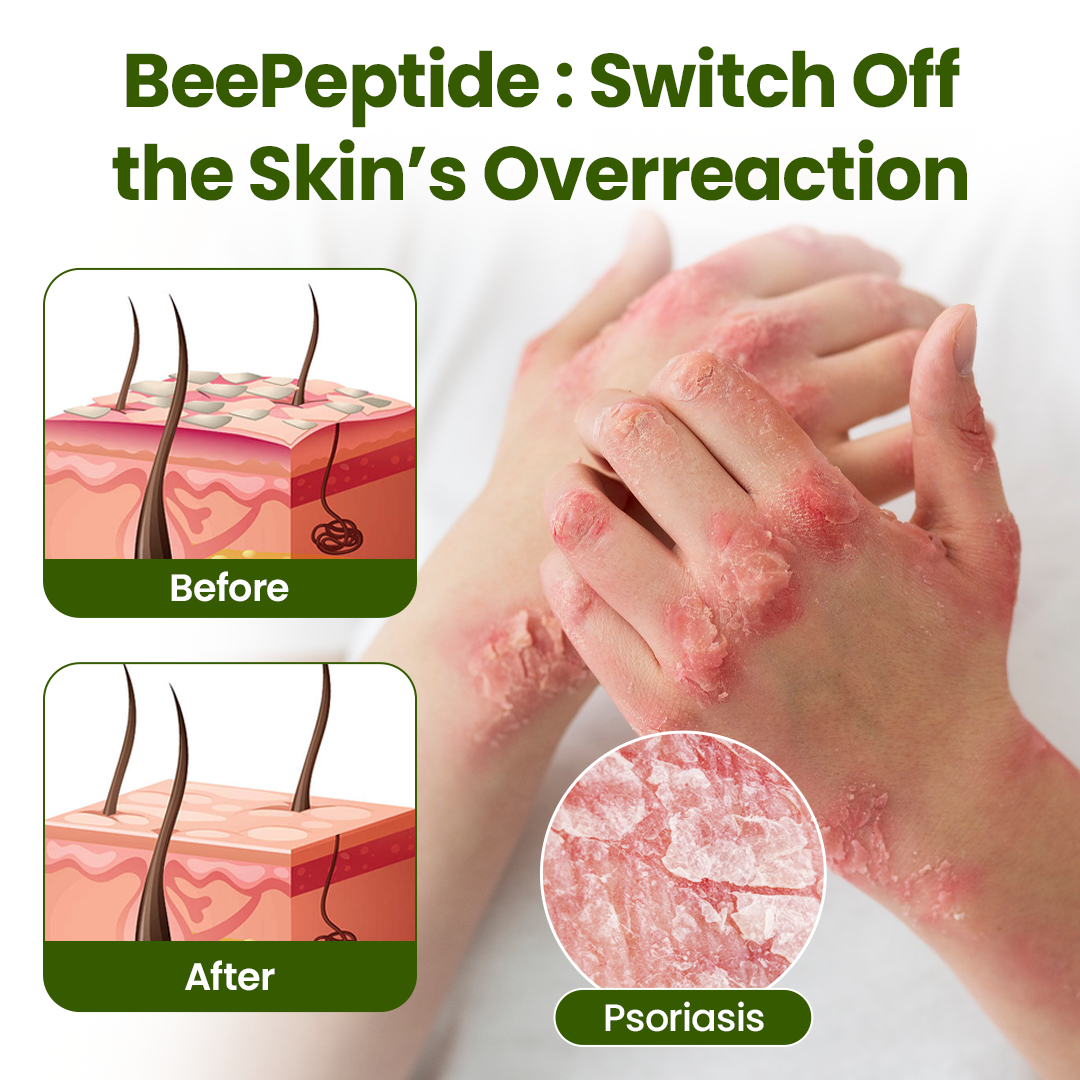 Timilk® BeePeptide RootSoft DualRelief Cream