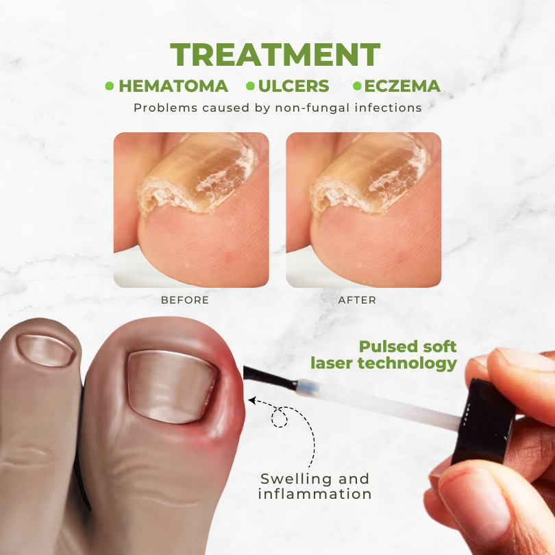 Nail Treatment Oil Bee Venom