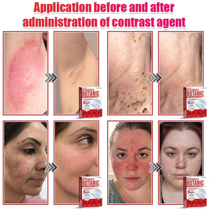 【Quick wart removal patch】plant-based wart removal