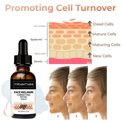 ✨Fast Dark Spot Remover-YIRANTIAN Melanin Correcting Facial Serum