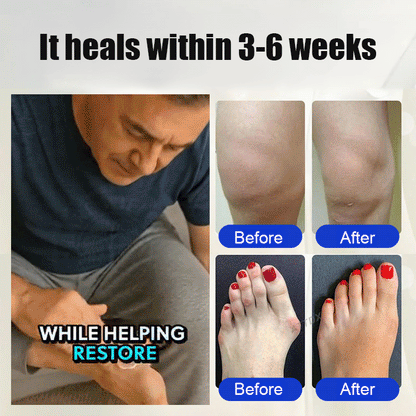 Foot nerve care cream-Give your feet the gentle care they deserve—step into relief now!