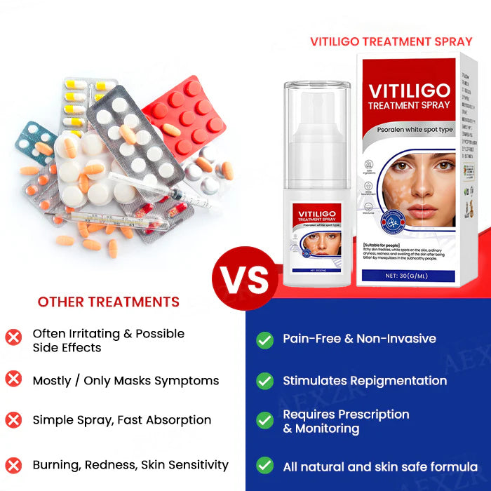 💥Hot Listing🔥Vitiligo Treatment Spray