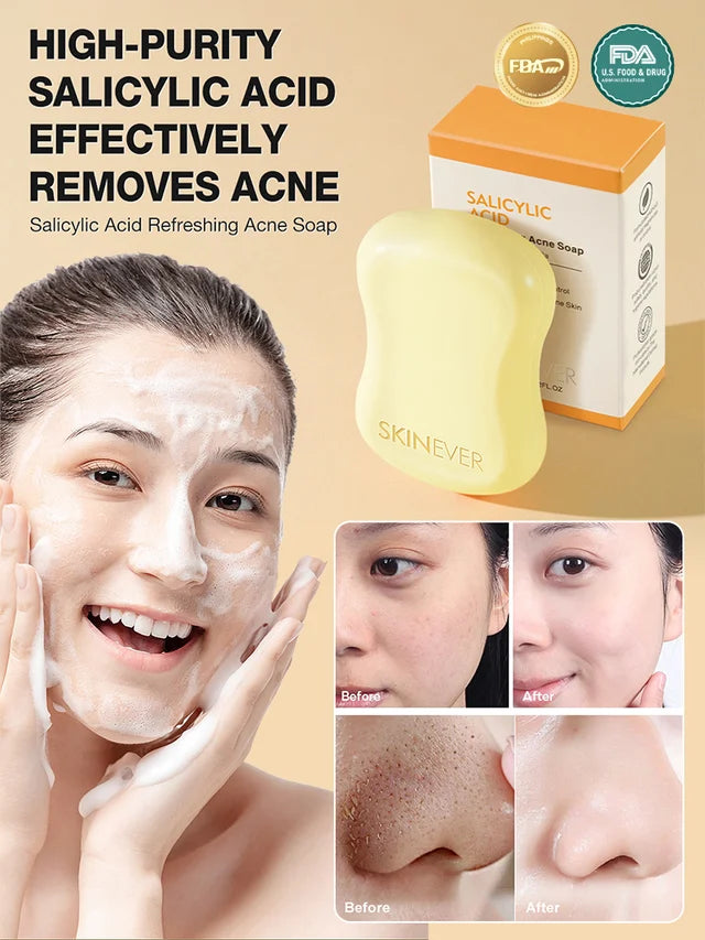 [Washes away 99.9% of dust mites] Salicylic acid soap