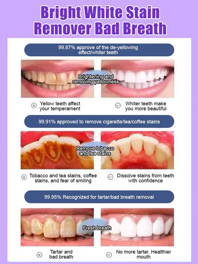 Gentle Cleansing Toothpaste