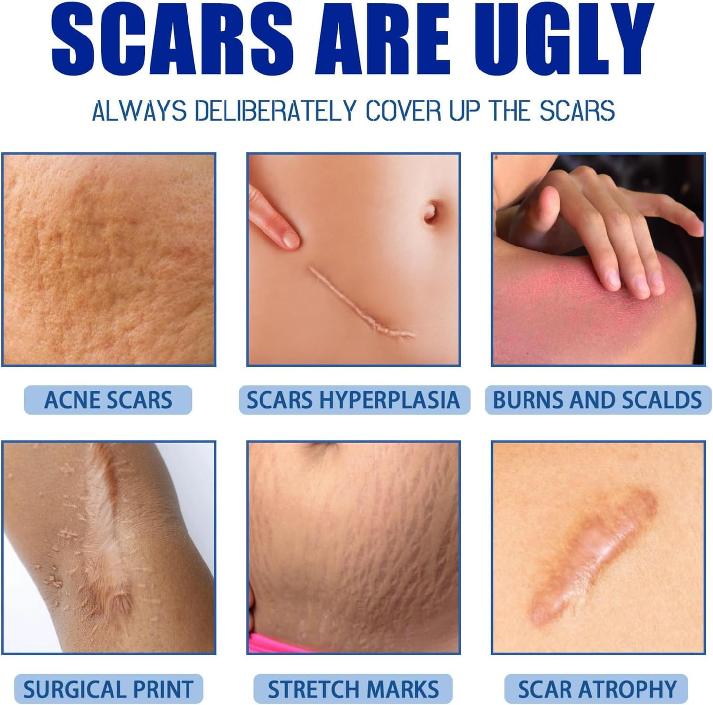 Scar Repair Cream for Men and Women, fade scars and tighten skin in one step