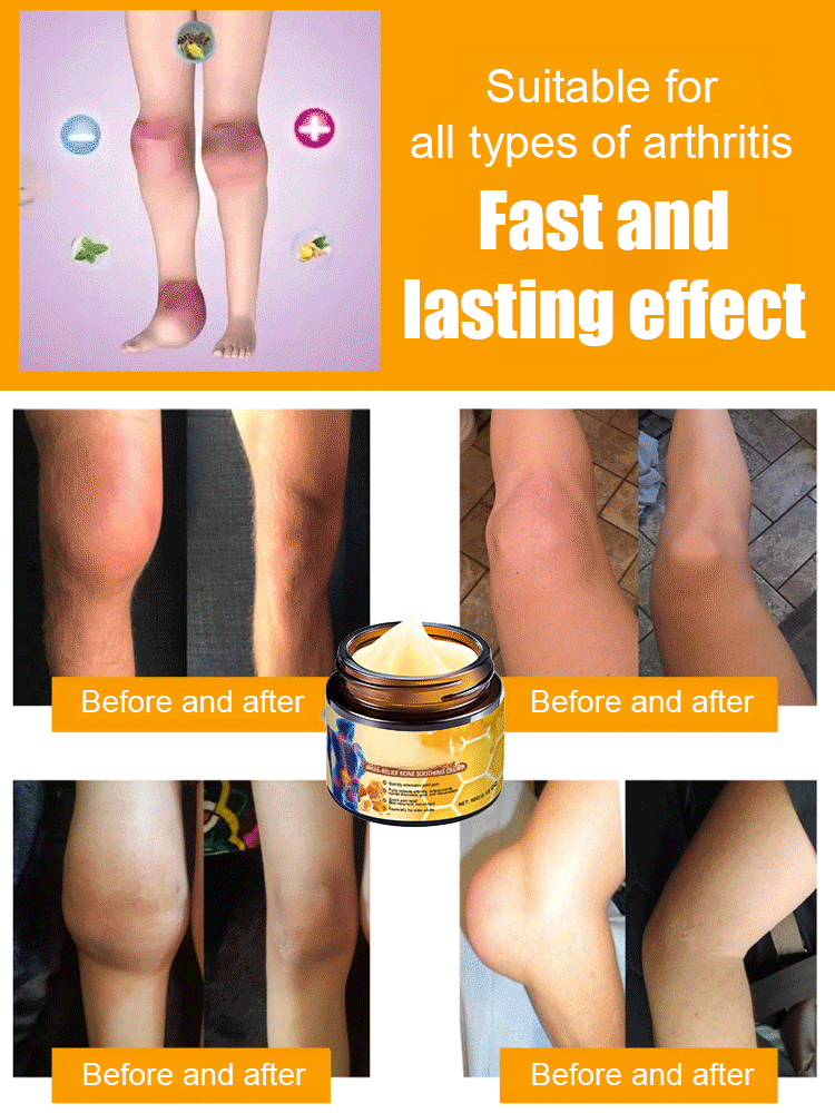 Bee Venom Joint Repair Cream