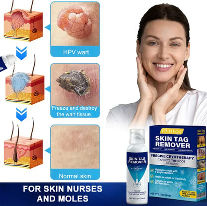 Cryotherapy Spray🌬️Instant cooling relief—say goodbye to discomfort, hello to comfort!