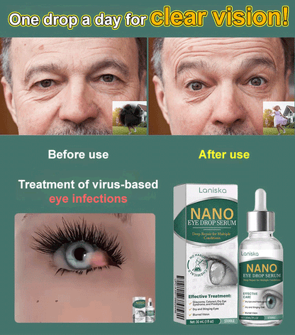 【Say Goodbye to Cataracts】Give You Clear Eyes