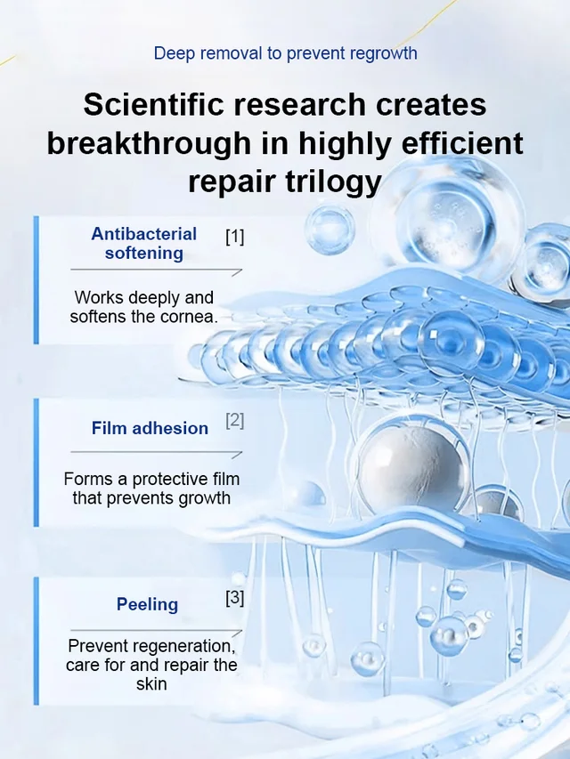 7 Days Pain-Free Herbal Cocoon Removal Cream