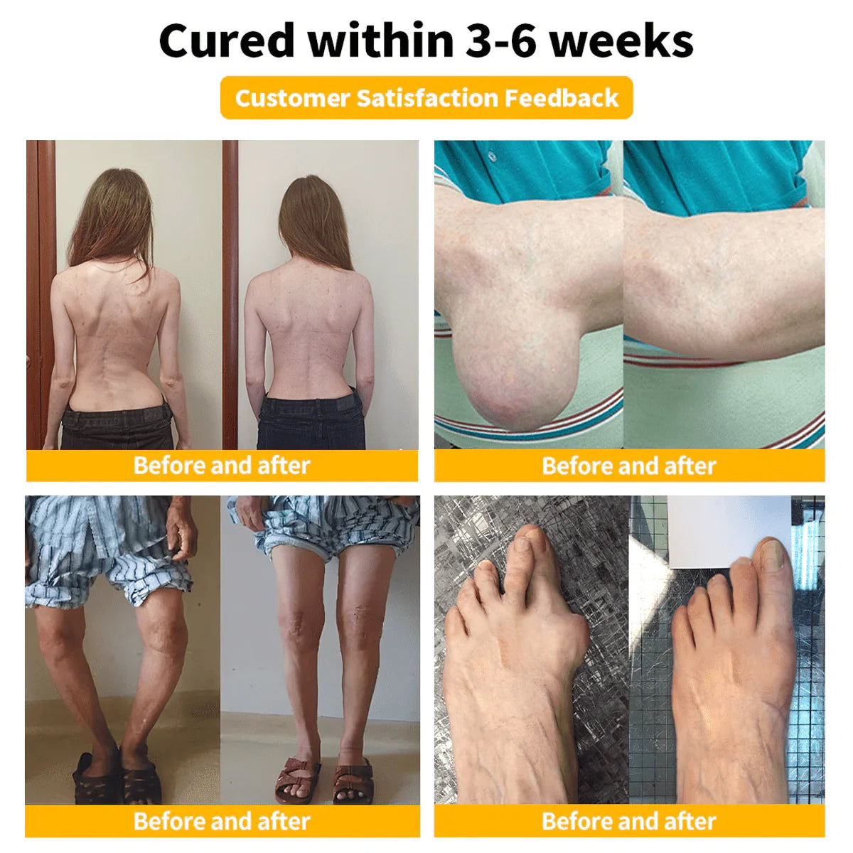 Zentheca BeeThera | Bee Venom-Infused Relief for Bones & Joints