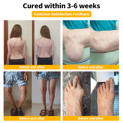 Zentheca BeeThera | Bee Venom-Infused Relief for Bones & Joints