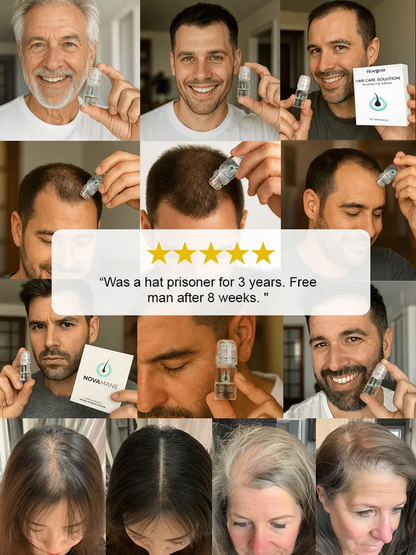 Reverse Hair Loss Roller Essence Set