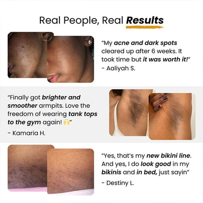 [Magic Spot Removal]Turmeric Kojic Acid De-darkening Handmade Soap