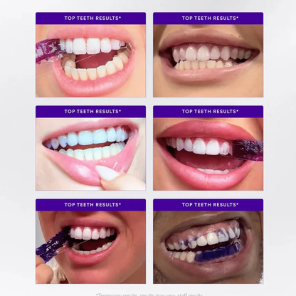 【Latest research and development】Purple instant whitening teeth stickers