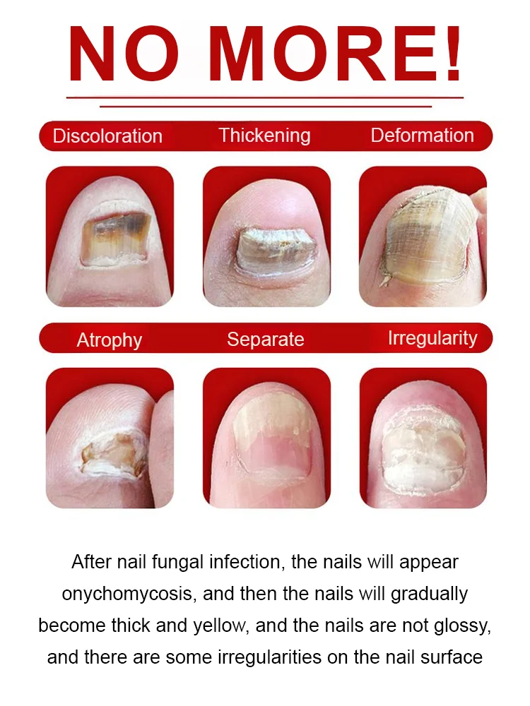 [Nail Care Solution]Professional Nail Repair Solution – Strengthen & Restore Nails