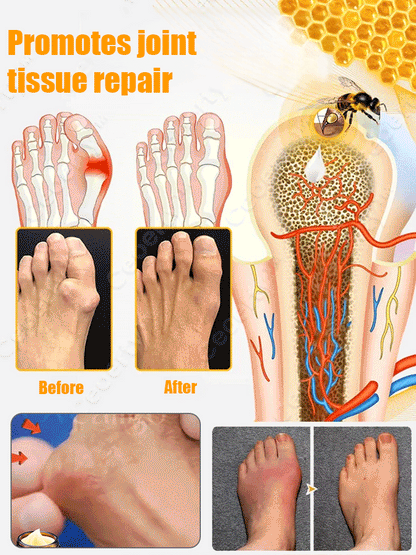 Bee Venom Joint Repair Cream