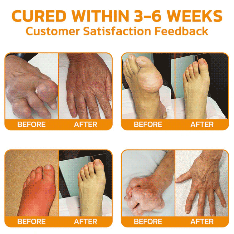 Laniska Bee Venom Joint Repair Cream