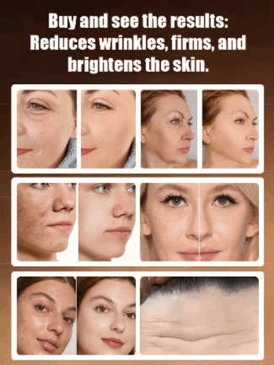 Arbutin and Niacinamide Anti-Wrinkle Cream