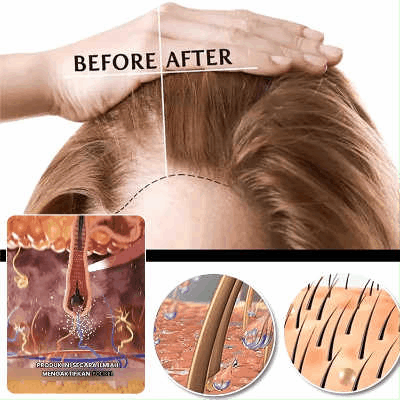 [Strong Hair Growth] Bio-Nourish Hair Essence