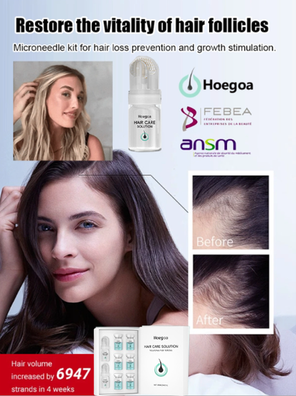 Reverse Hair Loss Roller Essence Set