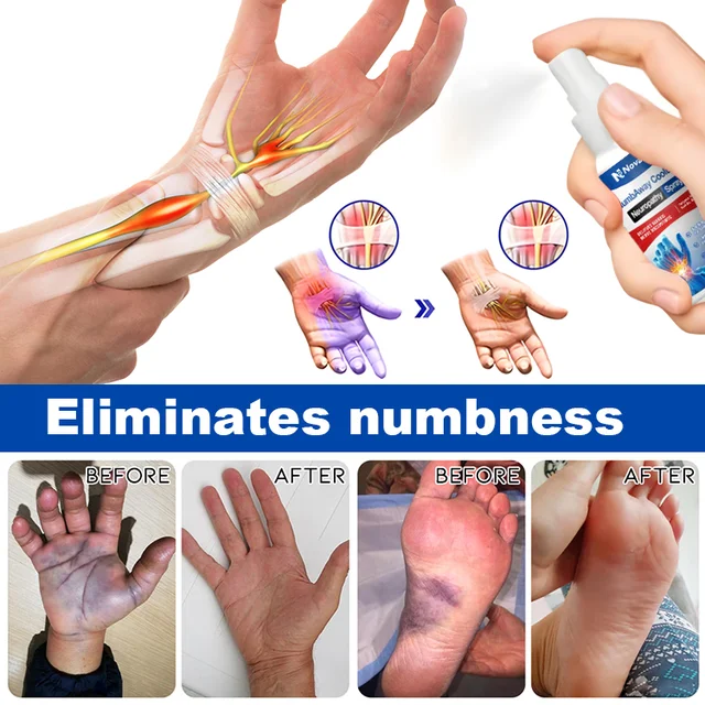 Cooling nerve pain relief spray